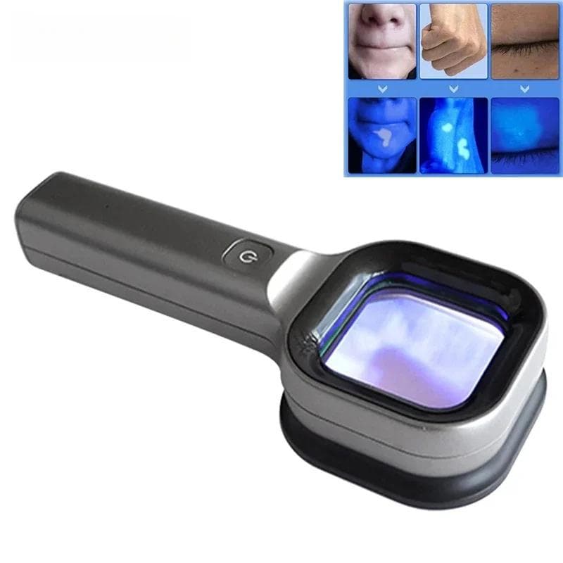 Lampă Wood Analizor Piele Piele UV Mărire Testare Piele Uz Casnic Testare Facială Lumină Wood Analiză Față Detectare Îngrijire Frumusețe